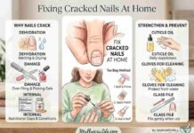 how to fix cracked nails at home