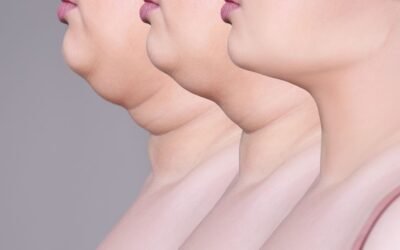 How to lose a double chin fast?