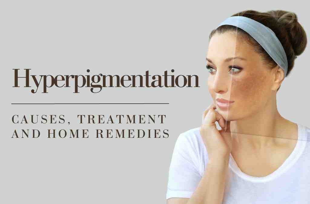 Home Remedies To Reduce Hyperpigmentation