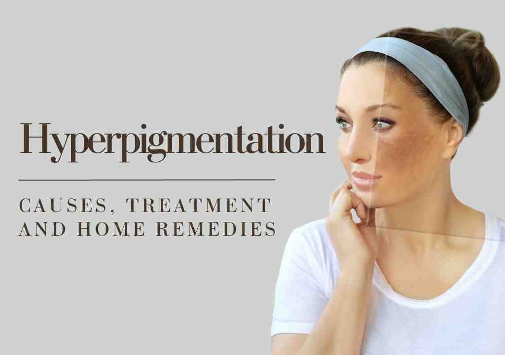 Home Remedies To Reduce Hyperpigmentation