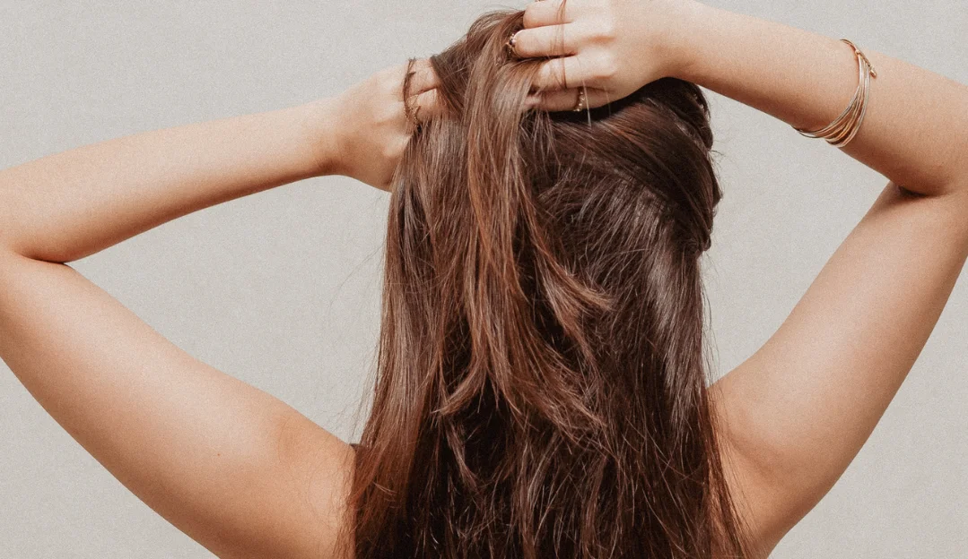 traction alopecia Traction Alopecia Prevention