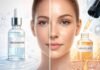 Niacinamide vs Salicylic Acid for Oily Skin: Which Ingredient Do You Actually Need? Niacinamide vs Salicylic Acid for Oily Skin