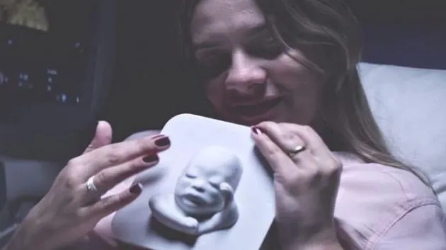 Blind mother-to-be given 3D scan of baby