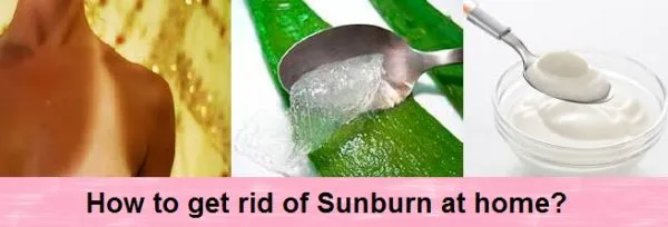 How to get rid of a Sunburn