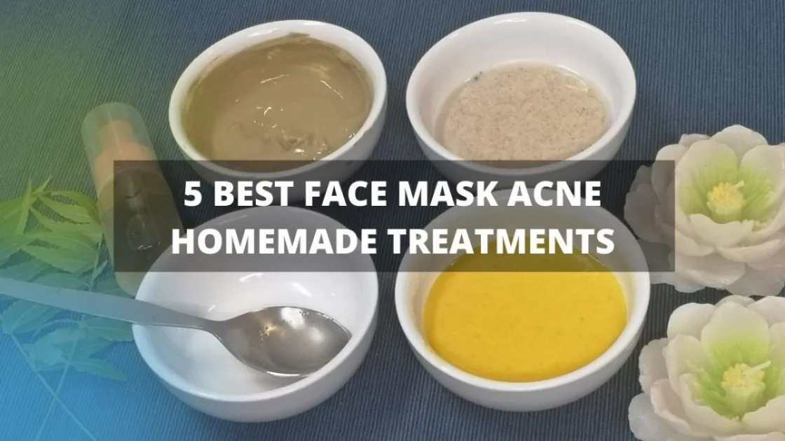 5 Best Face Mask Acne Homemade Treatments