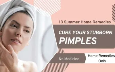 Home Remedies for Pimples on face in Summer