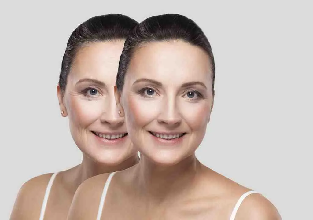 Niacinamide Cream for wrinkles over 40