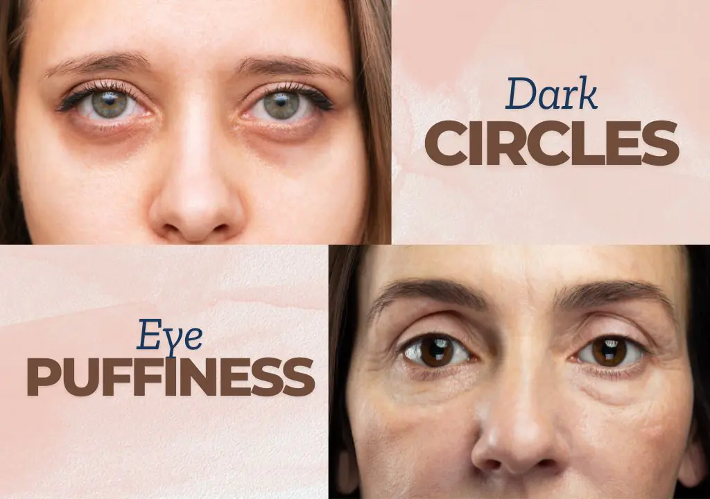 Eye Cream for Dark Circles and Puffiness